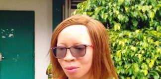 Côte d’Ivoire : Journée internationale de l’albinisme/ Mariam Koné vole au secours des albinos de Bouaké.